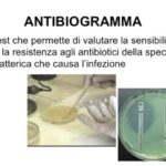 Prodotti senza lattosio Esselunga: Scopri le migliori opzioni
