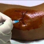 Rimedi per il dolore ai testicoli dopo l’eccitazione