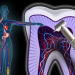 Dolore alla spalla e al braccio destro: cause e trattamenti
