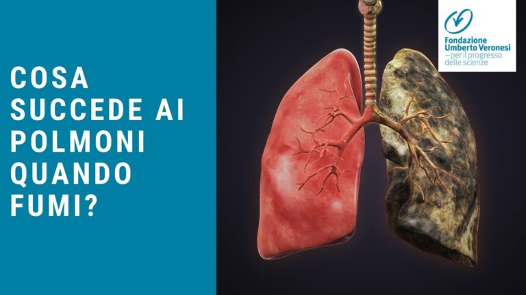 Radiografia dei Polmoni nei Fumatori: Cosa Rivelano?