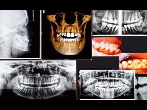 Centro Radiologico Vicino a Me: Guida per Trovare la Migliore Struttura