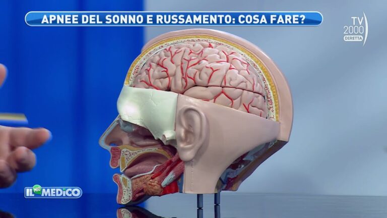 Guarire dalle Apnee Notturne: Possibilità e Approcci Efficaci