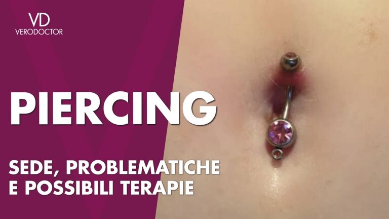 Guida completa ai cheloidi del piercing all’ombelico