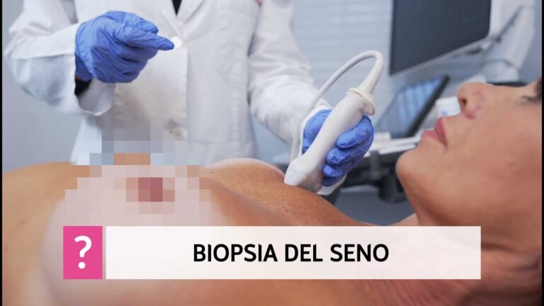 Calcificazione del seno: Cause, Diagnosi e Trattamenti
