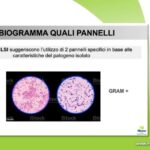 Cerotti per trocanterite: il rimedio salva