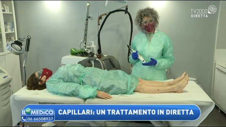 Rimedi Efficaci per i Capillari alle Gambe