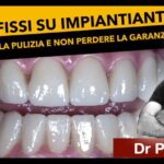 Durata della pulizia dentale: tutto ciò che devi sapere