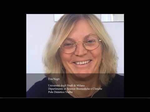 Universit&agrave; degli Studi di Milano – Polo Vialba: Guida Completa