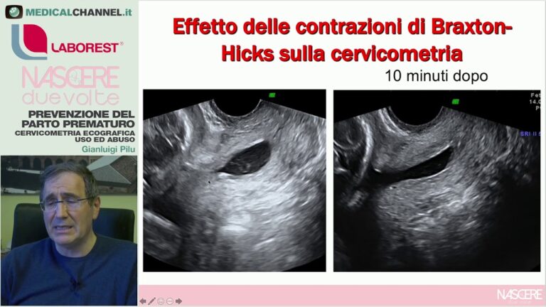 Collo dell’utero aperto: cause, sintomi e trattamenti