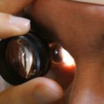 Denti sani e verruche miracolosamente scomparse: il segreto del dentifricio!