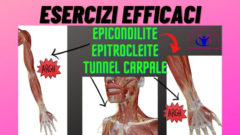 Come trattare la tendinite al polso esterno