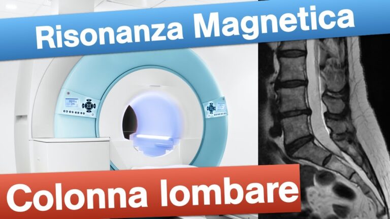 Risparmio sui Costi della Risonanza Magnetica della Schiena