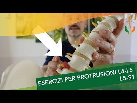 Protrusione discale L4-L5: Cause, Sintomi e Trattamenti