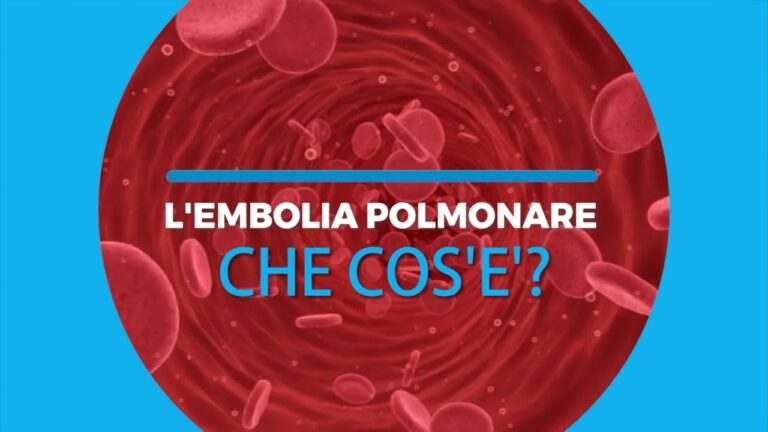 Rapido recupero dall’embolia polmonare: le tempistiche da conoscere