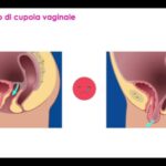Metformina 500: Prezzo ottimizzato e conciso – Guida all’acquisto