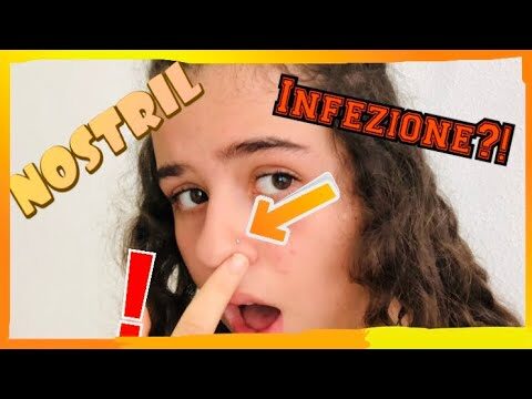 Trattamento efficace per l’infezione da bolla al piercing al naso