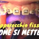 Balsamo di cavallo: il rimedio miracoloso per la cervicale