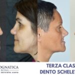 Come ottenere denti bianchi in soli 2 minuti