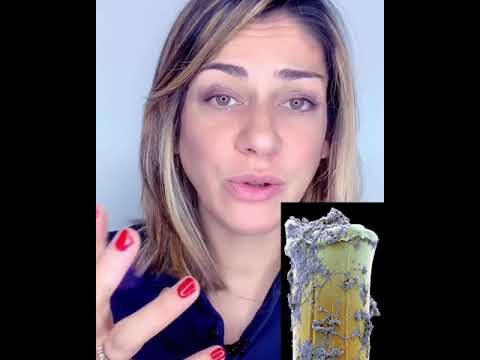 Come si Forma lo Smalto dei Denti