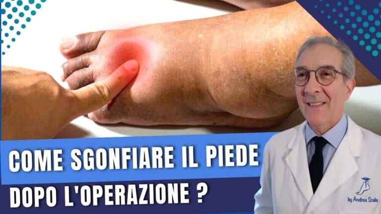 Malleolo Gonfio: Cause e Trattamenti Efficaci