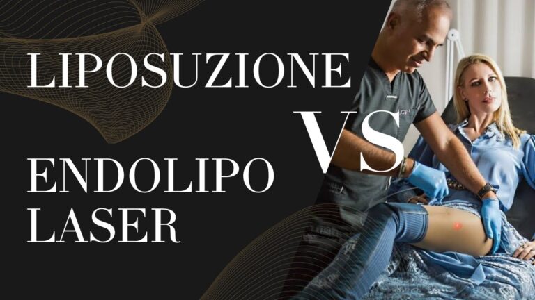 Rischi della liposuzione laser: cosa sapere