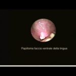 Incoves 5 mg: Prezzo Ottimizzato e Conveniente