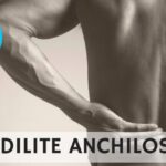 Lassativi Forti: Efficacia e Rischi da Conoscere