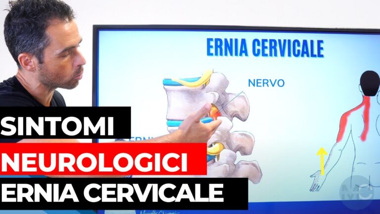 Sintomi Neurologici dell’Ernia Dorsale: Cosa Sapere