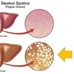 Costo di un Ponte Dentale: Guida Completa
