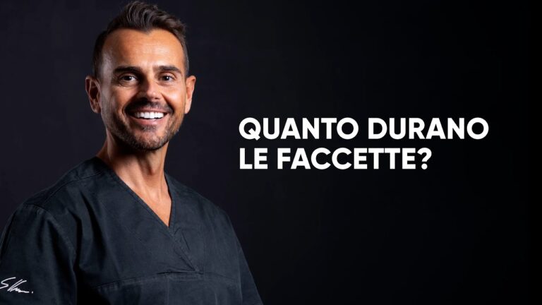 Durata delle faccette dentali: tutto ciò che devi sapere