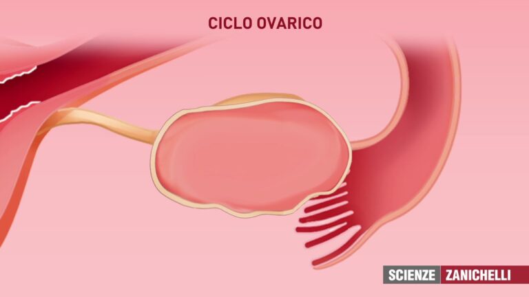 Dolore Ovarico Prima del Ciclo: Cause e Rimedi