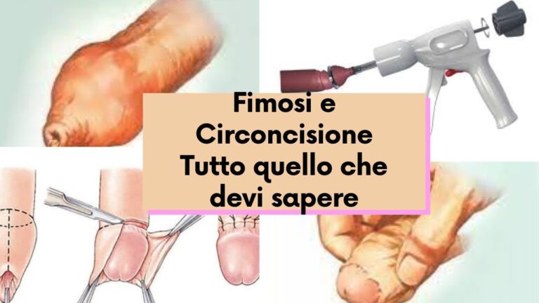 Circoncisione: Costi e Opzioni