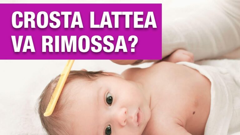 Guida all’uso del pettinino per la crosta lattea