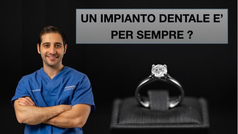 Durata degli impianti dentali: Quanto Resistono?