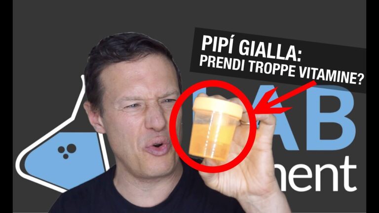 Segreti della pipì giallo fluo: cause e rimedi