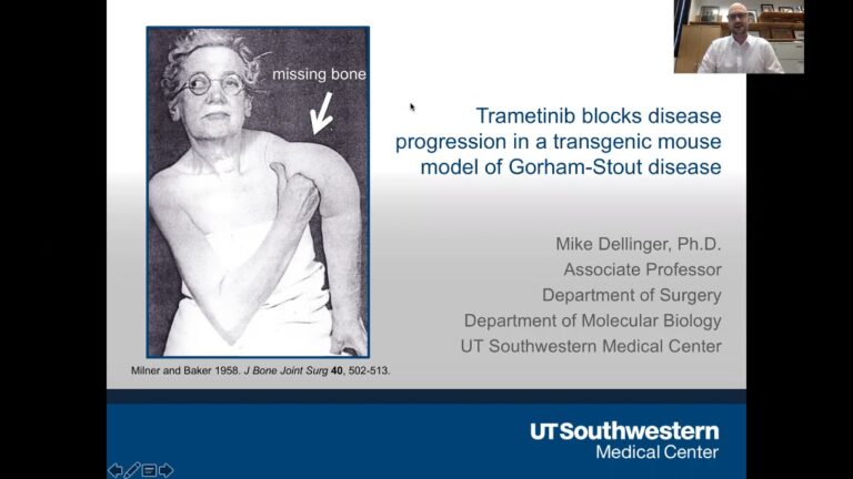Sindrome di Gorham-Stout: Comprendere e Affrontare questa Malattia Rara