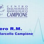 Come Riconoscere il Cancro Olfattivo: Sentire Puzza di Bruciato.