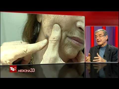 Cheratosi Lichenoide: Cause, Sintomi e Trattamenti