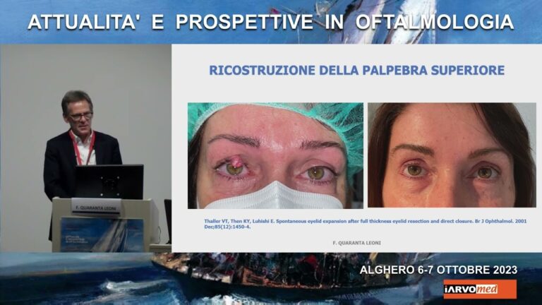 Tumore Palpebrale: Sintomi, Diagnosi e Trattamenti