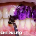 Durata della pulizia dei denti: tutto quello che devi sapere
