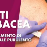Bentonel Crema: Efficacia e Utilizzi nel Trattamento della Pelle