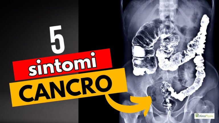 Diverticolite e tumore del colon: collegamento e gestione
