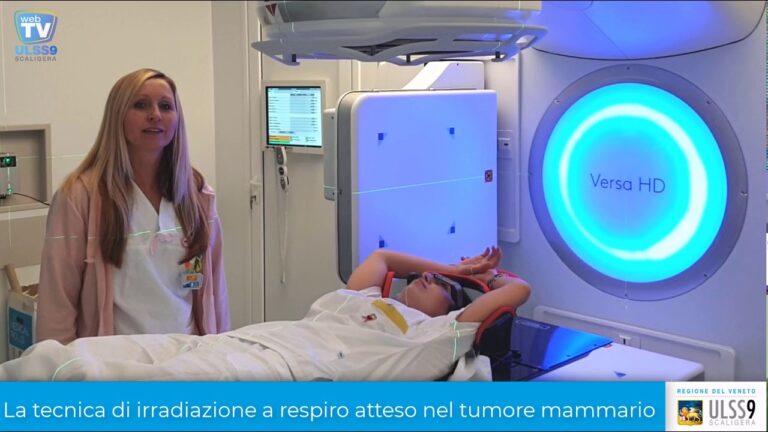 Radioterapia per le ustioni al seno: un approccio ottimizzato