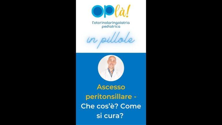 Trattamento efficace dell’ascesso in gola