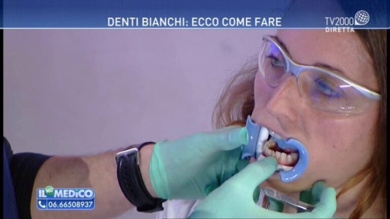 Vantaggi e svantaggi dello sbiancamento dentale