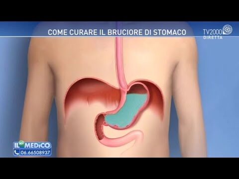 Soluzioni per l’Acidità di Stomaco Persistente