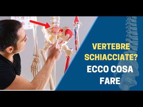 Schiacciamento della Vertebra Lombare: Sintomi e Riconoscimento