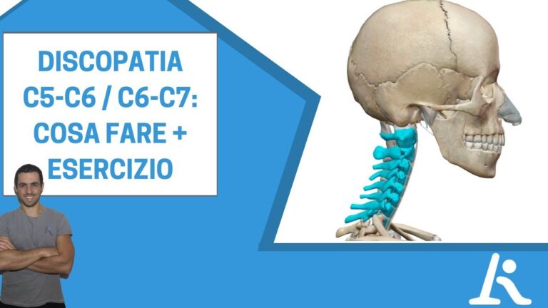 Protrusione dei Dischi Cervicali C3-C6: Cause e Trattamenti
