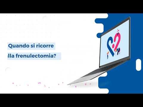 Trasformazione con la frenuloplastica: prima e dopo