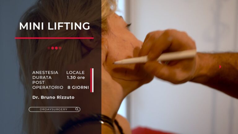 Il costo ottimizzato del mini lifting: tutto ciò che devi sapere
